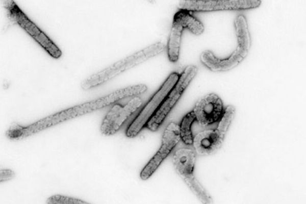 Биолог рассказала об опасности сексуальных контактов с переболевшими вирусом Марбург