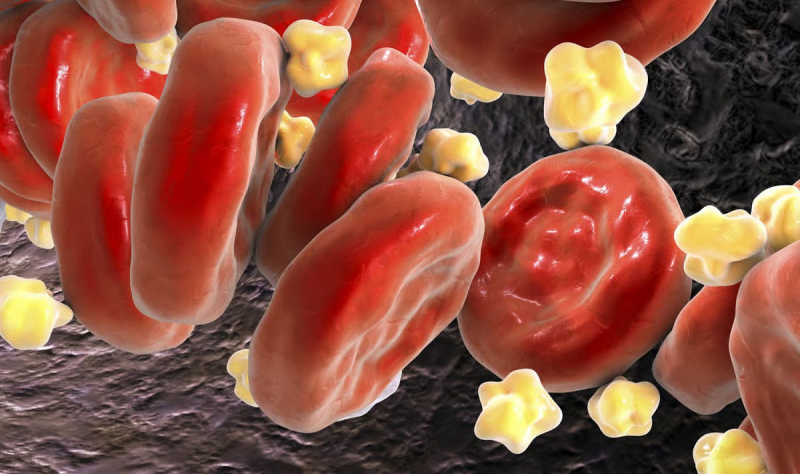 Комбинация двух препаратов снижает уровень холестерина в крови на 49 %