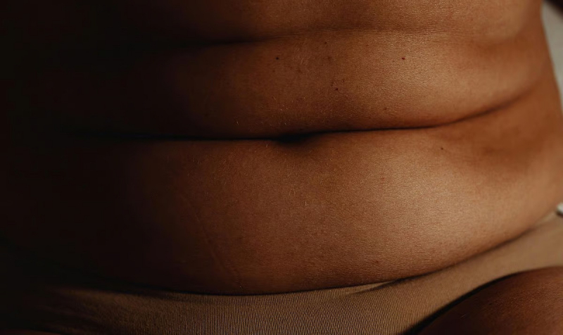 Один укол препарата MariTide от Amgen в месяц снижает вес на 16 процентов