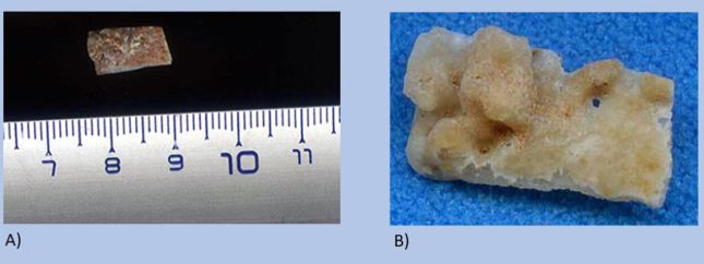 Загадочному черепу из греческой пещеры оказалось не менее 286 000 лет