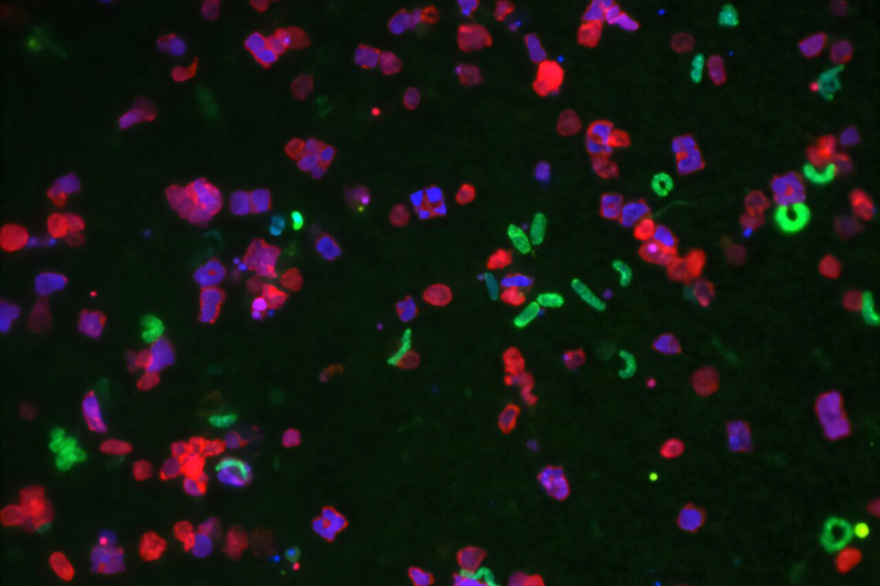 В Чили обнаружили бактерии, устойчивые ко всем современным антибиотикам