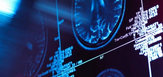 Мозг состоит из пяти «эпох», при этом взрослый режим начинается только в 30 лет