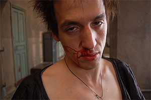 "Сколько сотрясений РјРѕР·РіР° Сѓ вас было?"