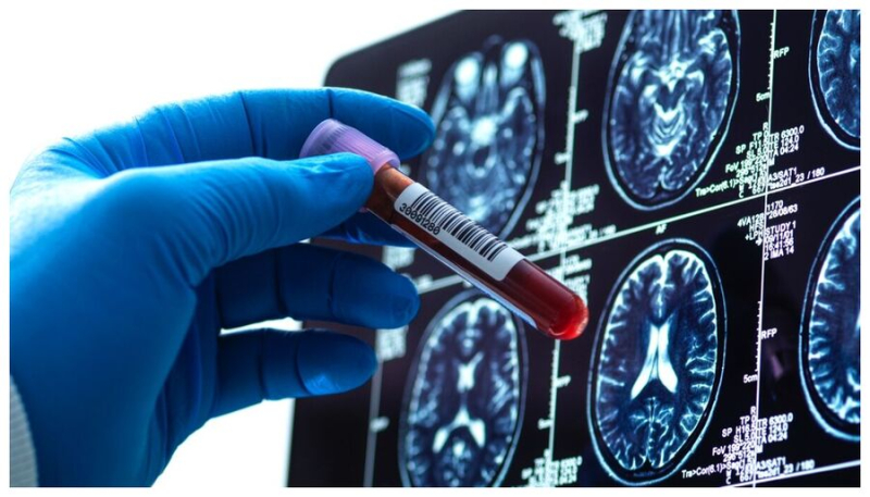 Суперредкая «гибридная» группа крови обнаружена всего у трёх человек