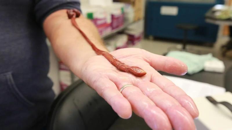 Ленточный червь переписал учебники биологии