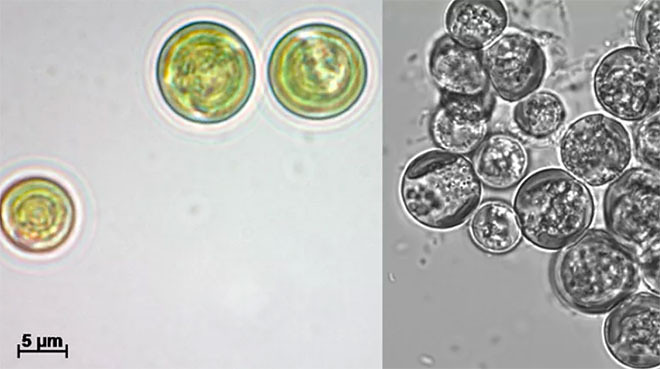 В России предложили делать детские смеси из микроводорослей