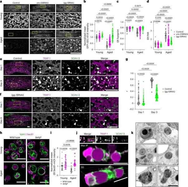 Ученые визуализировали стареющие клетки в живых организмах