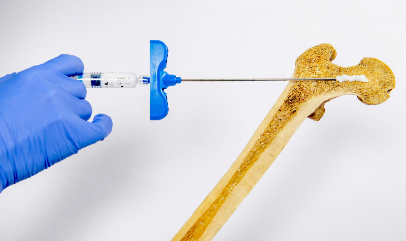 Инъекции костного геля помогут победить остеопороз