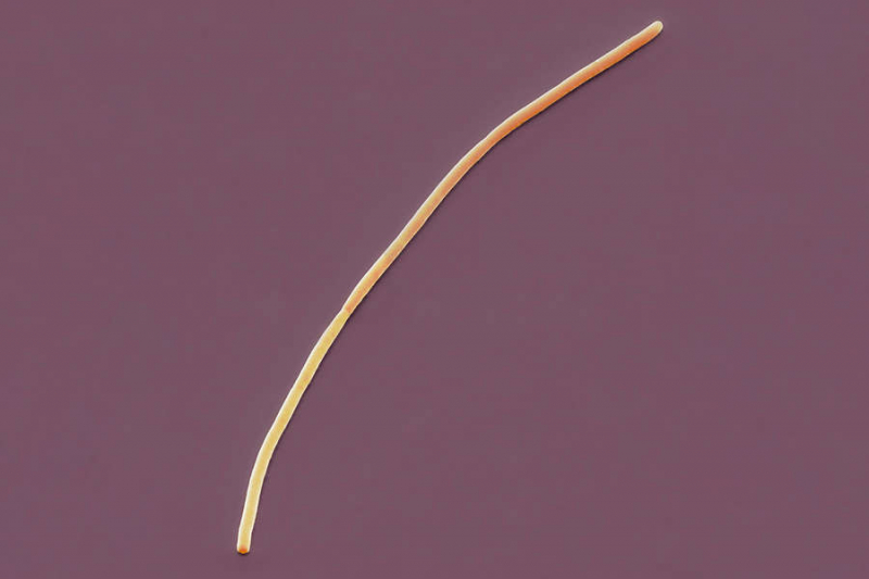 Открыта самая большая бактерия в мире — «промежуточное звено» между царствами природы