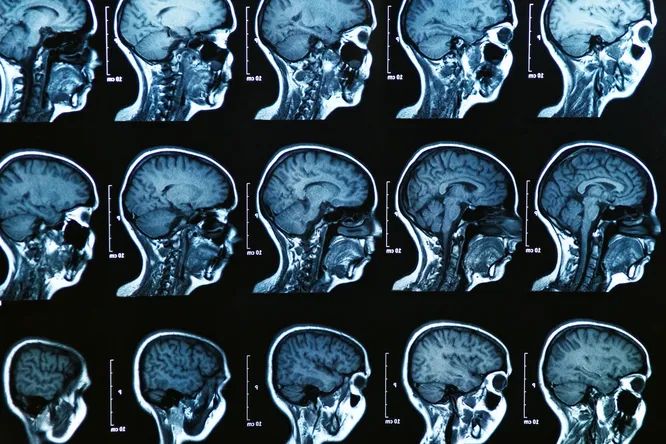 Ученые впервые проследили, как меняется мозг человека от рождения до смерти